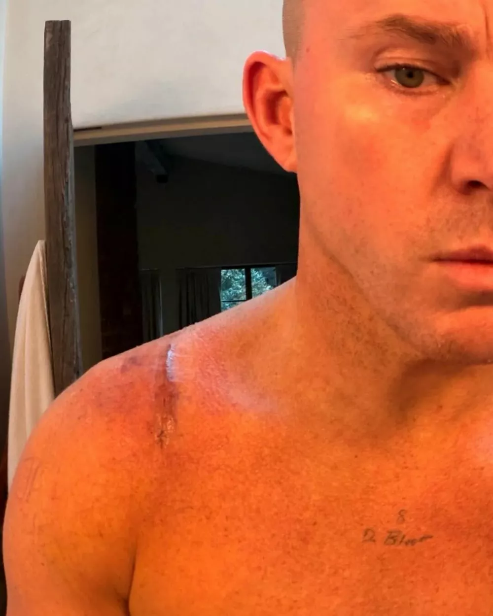 Ченнинг Татум показал гигантский шрам после операции на ключице