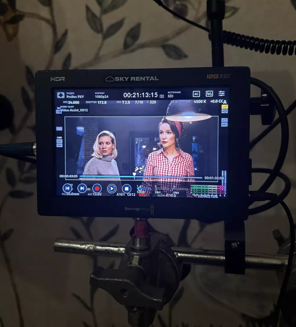 Кристина Асмус о здоровье: "Четыре года подряд я ломаю ноги и ношу костыли"