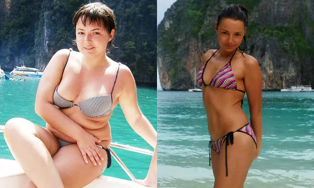 Реальные истории похудевших людей, фото до и после – Клиника бариатрической хирургии