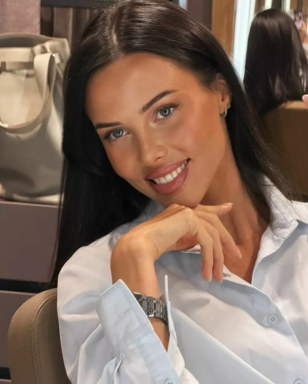 Анастасия после удаления геля из губ