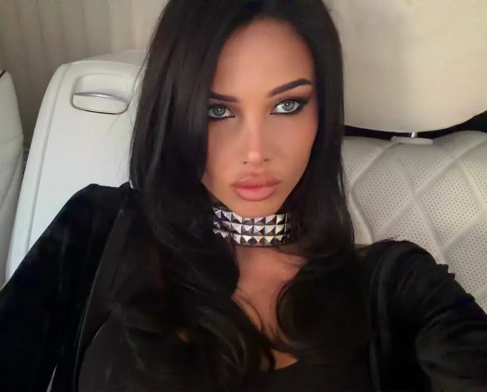 Анастасия до удаления геля из губ