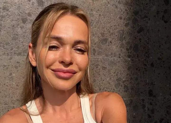 Анна Хилькевич решилась на пластическую операцию