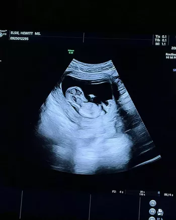 Из блога Элси