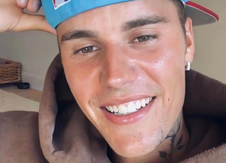“Pray for me”: Justin Bieber paralyzed half of the face